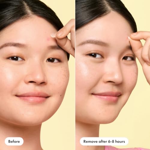 Hero Cosmetics Mighty Patch Mini Invisible+ Acne Pimple Patches, 30 Ct