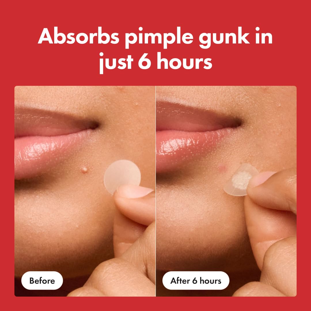 Hero Cosmetics Mighty Patch Mini Invisible+ Acne Pimple Patches, 30 Ct