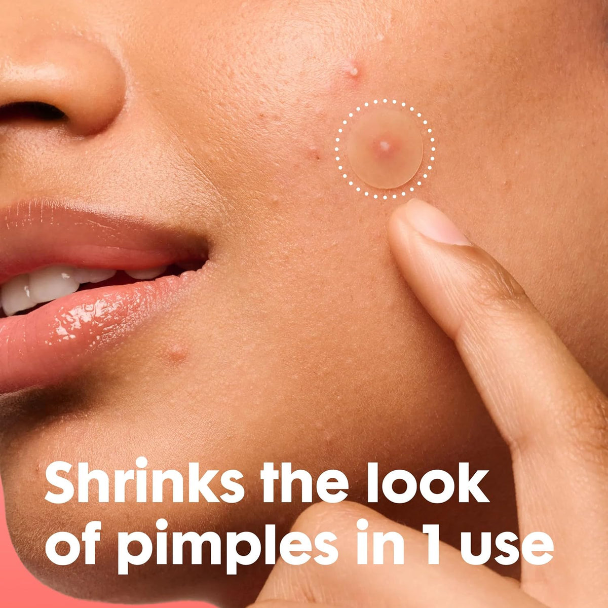 Hero Cosmetics Mighty Patch Mini Invisible+ Acne Pimple Patches, 30 Ct